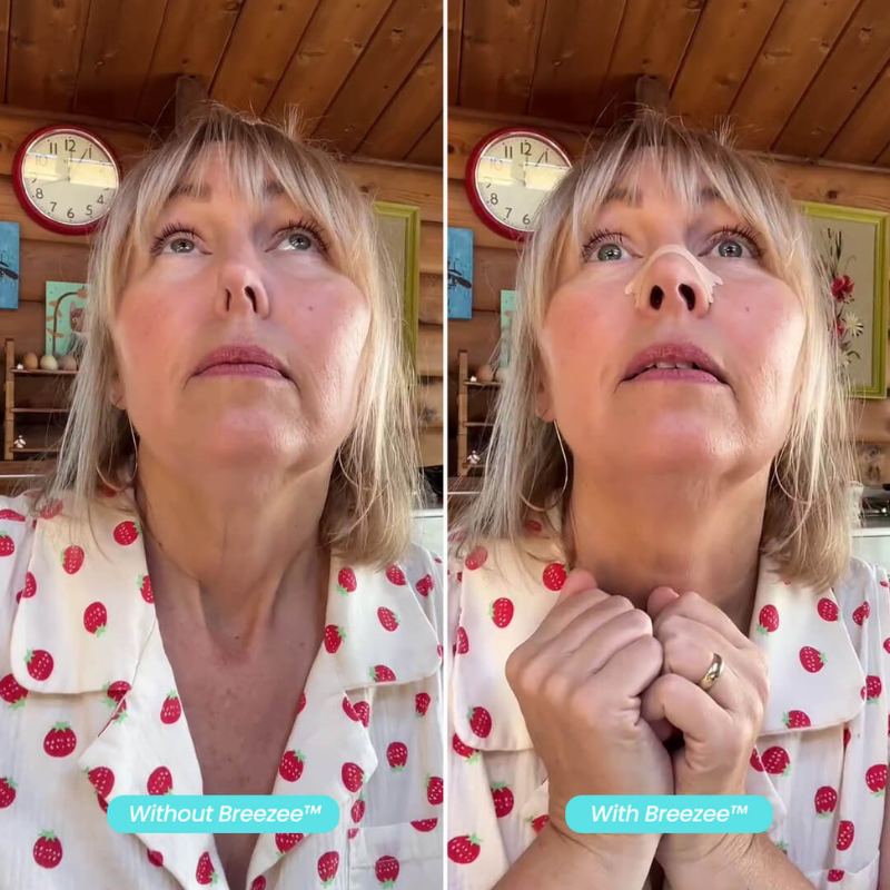 Breezee™ Breathing Strips